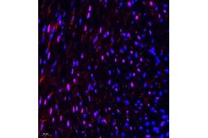 Immunofluorescence of paraffin embedded mouse heart using NSD3 (ABIN7076233) at dilution of 1:650 (400x lens) (WHSC1L1 抗体)