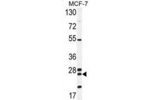 Western Blotting (WB) image for anti-Nudix Hydrolase 8 (NUDT8) antibody (ABIN2995714) (NUDT8 抗体)