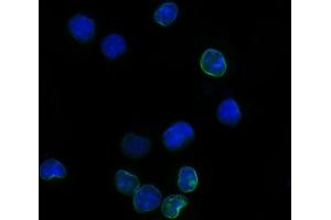 IF analysis of Il2ra using anti-Il2ra antibody (ABIN7600684).