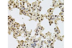 Immunohistochemistry of paraffin-embedded Rat lung using ZNF408 Polyclonal Antibody at dilution of 1:100 (40x lens). (ZNF408 抗体)