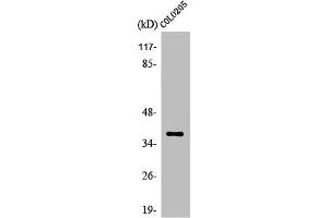 Western Blot analysis of Jurkat cells using Olfactory receptor 5K1 Polyclonal Antibody (OR5K1 抗体  (Internal Region))