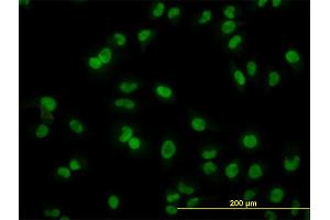 Immunofluorescence of monoclonal antibody to ARL6IP4 on HeLa cell. (ARL6IP4 抗体  (AA 261-360))