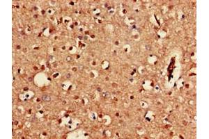 Immunohistochemistry of paraffin-embedded human brain tissue using ABIN7153285 at dilution of 1:100 (KCNJ3 抗体  (AA 350-487))