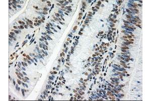 Image no. 5 for anti-Myc Proto-Oncogene protein (MYC) antibody (ABIN1497011) (c-MYC 抗体)