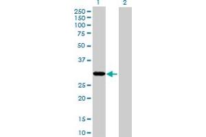 Western Blot analysis of THAP1 expression in transfected 293T cell line by THAP1 MaxPab polyclonal antibody. (THAP1 抗体  (AA 1-213))