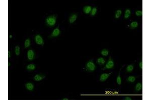 Image no. 3 for anti-Cullin-Associated and Neddylation-Dissociated 1 (CAND1) (AA 1-101) antibody (ABIN599270) (CAND1 抗体  (AA 1-101))