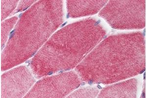 Human Skeletal Muscle (formalin-fixed, paraffin-embedded) stained with PAK2 antibody ABIN214460 at 2. (PAK2 抗体  (C-Term))