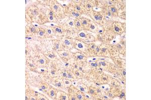 Immunohistochemistry of paraffin-embedded human liver injury using TXN2 antibody. (TXN2 抗体)
