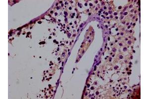 Immunohistochemistry (IHC) image for anti-G Protein-Coupled Receptor, Family C, Group 6, Member A (GPRC6A) (AA 403-581) antibody (ABIN7153367)