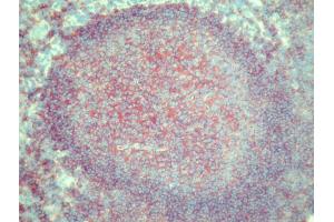 Immunohistochemistry (IHC) image for anti-MHC Class II HLA-DQ (HLA-DQ) antibody (Biotin) (ABIN452105) (HLA DQ 抗体  (Biotin))