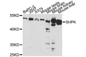 Western blot analysis of extracts of various cell lines, using SHPK antibody (ABIN5996627) at 1:3000 dilution. (SHPK 抗体)