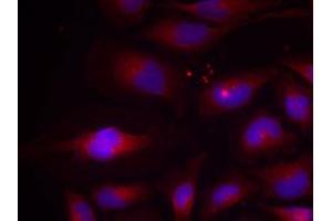 Immunofluorescent staining of methanol-fixed Hela cells using NFKB2 (phospho S870) polyclonal antibody  at 1:100-1:200 dilution. (NFKB2 抗体  (pSer870))