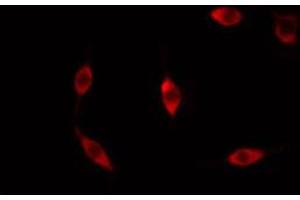 Immunofluorescence (fixed cells) (IF/ICC) image for anti-Protein Kinase C, theta (PRKCQ) (pSer676) antibody (ABIN6256401)