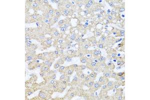 Immunohistochemistry of paraffin-embedded human liver injury using ARL6 antibody at dilution of 1:100 (x40 lens). (ARL6 抗体)