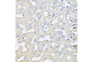 Immunohistochemistry of paraffin-embedded human liver injury using ARL6 antibody at dilution of 1:100 (x40 lens). (ARL6 抗体)