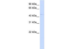 WB Suggested Anti-ZDHHC16 Antibody Titration:  0. (ZDHHC16 抗体  (C-Term))
