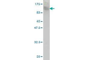 Western Blot detection against Immunogen (120. (TOP3B 抗体  (AA 1-862))