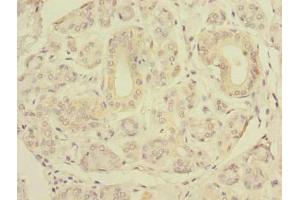 Immunohistochemistry (IHC) image for anti-Solute Carrier Family 4, Sodium Bicarbonate Cotransporter, Member 8 (SLC4A8) (AA 1-300) antibody (ABIN7151506)