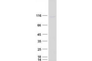 Western Blotting (WB) image for GC-Rich Sequence DNA-Binding Factor 2 (GCFC2) protein (Myc-DYKDDDDK Tag) (ABIN2721760)