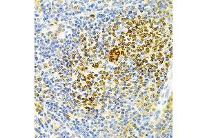 Immunohistochemistry of paraffin-embedded rat spleen using TNFRSF11B Antibody (ABIN3022914, ABIN3022915, ABIN3022916 and ABIN6219293) at dilution of 1:200 (40x lens). (Osteoprotegerin 抗体  (AA 22-280))