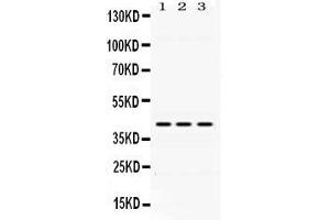 Western blot analysis of DHODH expression in rat liver extract ( Lane 1), mouse spleen extract ( Lane 2) and HEPG2 whole cell lysates ( Lane 3). (DHODH 抗体  (N-Term))