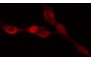 ABIN6274988 staining HepG2 cells by IF/ICC. (CEP170 抗体  (Internal Region))