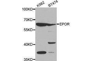 Western blot analysis of extracts of various cell lines, using EPOR antibody. (EPOR 抗体  (AA 274-508))
