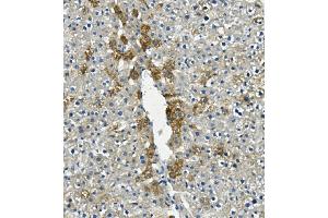IHC analysis of LIPC using anti-LIPC antibody (ABIN7601582). (LIPC 抗体  (AA 39-494))