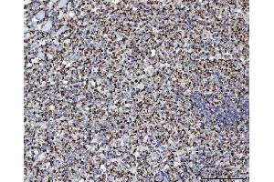 IHC analysis of MFF using anti-MFF antibody (ABIN7599292). (MFF 抗体  (AA 1-342))