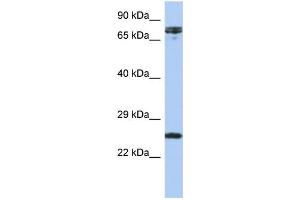 WB Suggested Anti-HNF1A Antibody Titration:  0. (HNF1A 抗体  (N-Term))