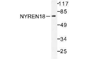 Image no. 1 for anti-Negative Regulator of Ubiquitin-Like Proteins 1 (NUB1) antibody (ABIN271950) (NUB1 抗体)