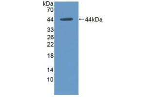 Western Blotting (WB) image for anti-Hexokinase 1 (HK1) (AA 413-540) antibody (ABIN7437755)