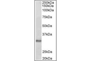 Staining of Mouse Testis lysate (35µg protein in RIPA buffer) using CTDSP1 antibody at 0. (CTDSP1 抗体  (Internal Region))