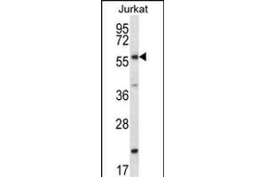 FOXJ3 Antibody (N-term) (ABIN657277 and ABIN2846366) western blot analysis in Jurkat cell line lysates (35 μg/lane). (FOXJ3 抗体  (N-Term))