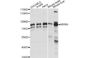 Western blot analysis of extracts of various cell lines, using MYNN antibody (ABIN6291174) at 1:1000 dilution. (Myoneurin 抗体)