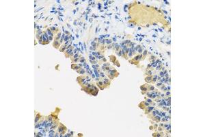 Immunohistochemistry of paraffin-embedded mouse lung using ANGPT1 antibody (ABIN5974767) at dilution of 1/100 (40x lens). (Angiopoietin 1 抗体)