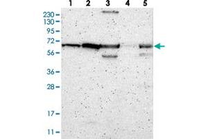 Western blot analysis of Lane 1: RT-4, Lane 2: U-251 MG, Lane 3: Human Plasma, Lane 4: Liver, Lane 5: Tonsil with ME2 polyclonal antibody  at 1:250-1:500 dilution. (NAD-ME 抗体)