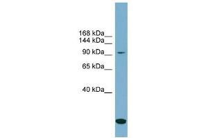 SLC12A4 antibody used at 1 ug/ml to detect target protein. (SLC12A4 抗体)