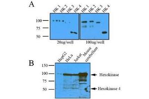 (A): Recombinant protein (20ng or 100ng) of Hexokinase four isoform were resolved by SDS-PAGE, transferred to nitrocellulose membrane and probed with anti-human Hexokinase (1:1000). (Hexokinase 抗体  (AA 1-917))