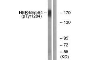 Western blot analysis of extracts from HuvEc cells treated with EGF 200ng/ml 30', using HER4 (Phospho-Tyr1284) Antibody. (ERBB4 抗体  (pTyr1284))