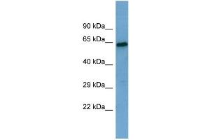 Western Blotting (WB) image for anti-Sestrin 1 (SESN1) (Middle Region) antibody (ABIN2786032) (SESN1 抗体  (Middle Region))