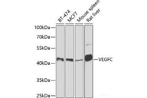 Western blot analysis of extracts of various cell lines using VEGFC Polyclonal Antibody at dilution of 1:500.