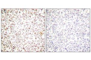 Immunohistochemical analysis of paraffin-embedded human lymph node tissue using OCT-1 antibody (ABIN5976471). (POU2F1 抗体  (N-Term))