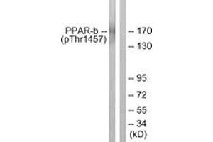 Western blot analysis of extracts from HuvEc cells treated with Serum 20% 30', using PPAR-BP (Phospho-Thr1457) Antibody. (PPAR-BP (AA 1423-1472), (pThr1457) 抗体)