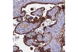 Immunohistochemical staining of human placenta with EID2 polyclonal antibody  shows strong granular cytoplasmic positivity in trophoblastic cells. (EID2 抗体)
