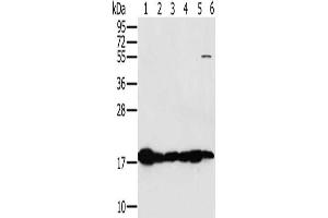 Gel: 10 % SDS-PAGE, Lysate: 40 μg, Lane 1-6: Mouse heart tissue, Mouse muscle tissue, hela cells, mouse liver tissue tissue, mouse kidney tissue, hepg2 cells, Primary antibody: ABIN7130290(MTFP1 Antibody) at dilution 1/450, Secondary antibody: Goat anti rabbit IgG at 1/8000 dilution, Exposure time: 5 seconds (Mtfp1 抗体)