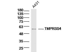 Lane 1: A431 lysates probed with TMPRSS4 Polyclonal Antibody, Unconjugated  at 1:300 overnight at 4˚C. (TMPRSS4 抗体  (AA 84-130))