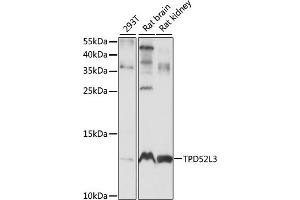 Western blot analysis of extracts of various cell lines, using TPD52L3 antibody (ABIN7271078) at 1:1000 dilution. (TPD52L3 抗体  (AA 1-132))