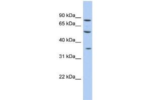 WB Suggested Anti-FAM63A Antibody Titration: 0. (FAM63A 抗体  (Middle Region))