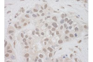 anti-Suppressor of Ty 7 Like (SUPT7L) (AA 364-414) antibody